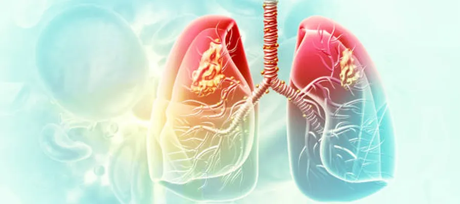 What are the Most Dangerous Lung Diseases?