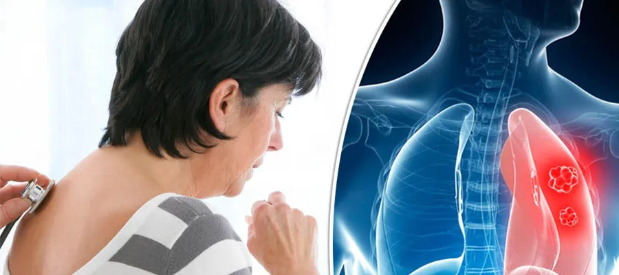 What is the First Sign of Lung Cancer?