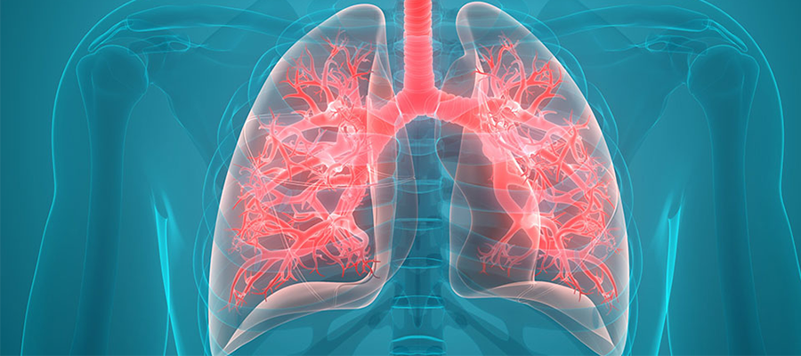 COPD Balloon Treatment